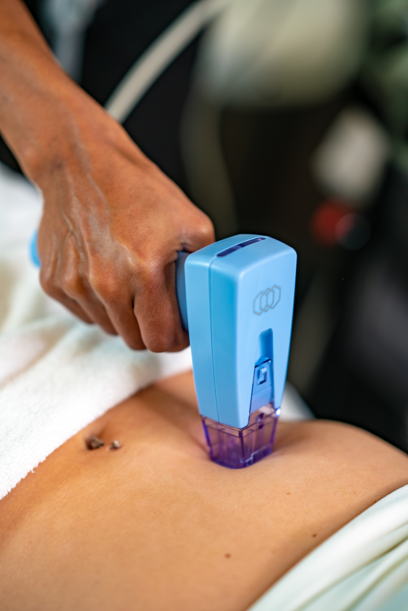 procedure laser product